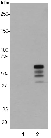 Western blot - Anti-Vimentin (phospho S82) antibody [EP1071Y] (AB52943)