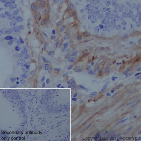 Immunohistochemistry (Formalin/PFA-fixed paraffin-embedded sections) - Anti-Vinculin antibody [EPR20407] - BSA and Azide free (AB240395), expandable thumbnail