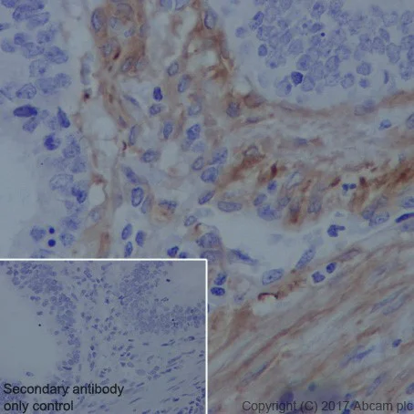 Immunohistochemistry (Formalin/PFA-fixed paraffin-embedded sections) - Anti-Vinculin antibody [EPR20407] - BSA and Azide free (AB240395)