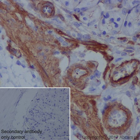 Immunohistochemistry (Formalin/PFA-fixed paraffin-embedded sections) - Anti-Vinculin antibody [EPR20407] - BSA and Azide free (ab240395), expandable thumbnail