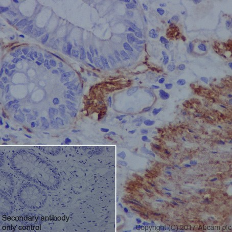 Immunohistochemistry (Formalin/PFA-fixed paraffin-embedded sections) - Anti-Vinculin antibody [EPR20407] - BSA and Azide free (AB240395), expandable thumbnail