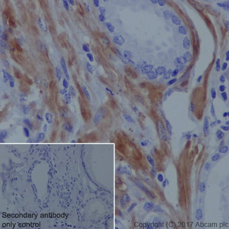 Immunohistochemistry (Formalin/PFA-fixed paraffin-embedded sections) - Anti-Vinculin antibody [EPR20407] - BSA and Azide free (AB240395), expandable thumbnail