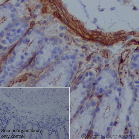 Immunohistochemistry (Formalin/PFA-fixed paraffin-embedded sections) - Anti-Vinculin antibody [EPR20407] - BSA and Azide free (ab240395), expandable thumbnail