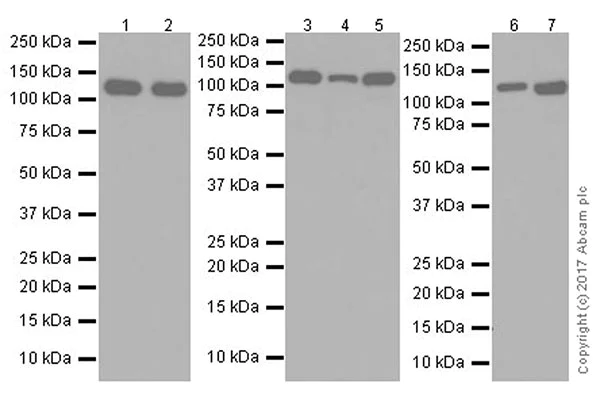 Western blot - Anti-Vinculin antibody [EPR20407] - Loading Control (AB219649)