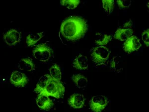 Immunocytochemistry/ Immunofluorescence - Anti-Vinculin antibody [EPR8185] - BSA and Azide free (AB217171)
