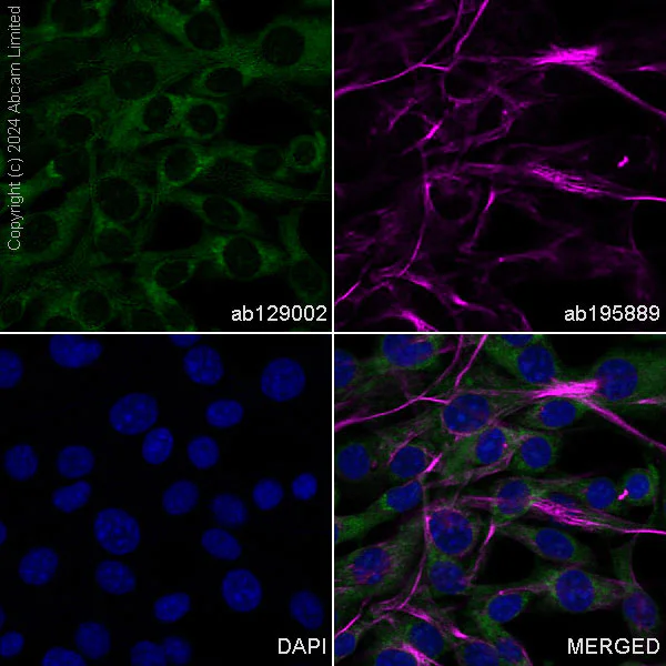 Immunocytochemistry/ Immunofluorescence - Anti-Vinculin antibody [EPR8185] - BSA and Azide free (AB217171)