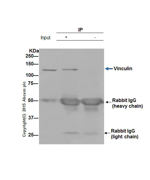 Immunoprecipitation - Anti-Vinculin antibody [EPR8185] - BSA and Azide free (AB217171)