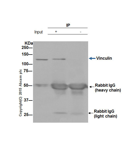 Immunoprecipitation - Anti-Vinculin antibody [EPR8185] - Loading Control (AB129002), expandable thumbnail