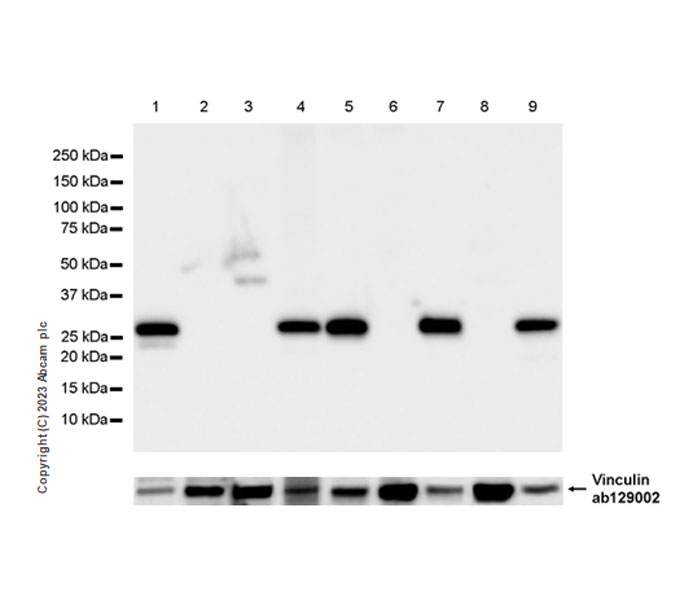 Western blot - Anti-Vinculin antibody [EPR8185] - Loading Control (ab129002), expandable thumbnail