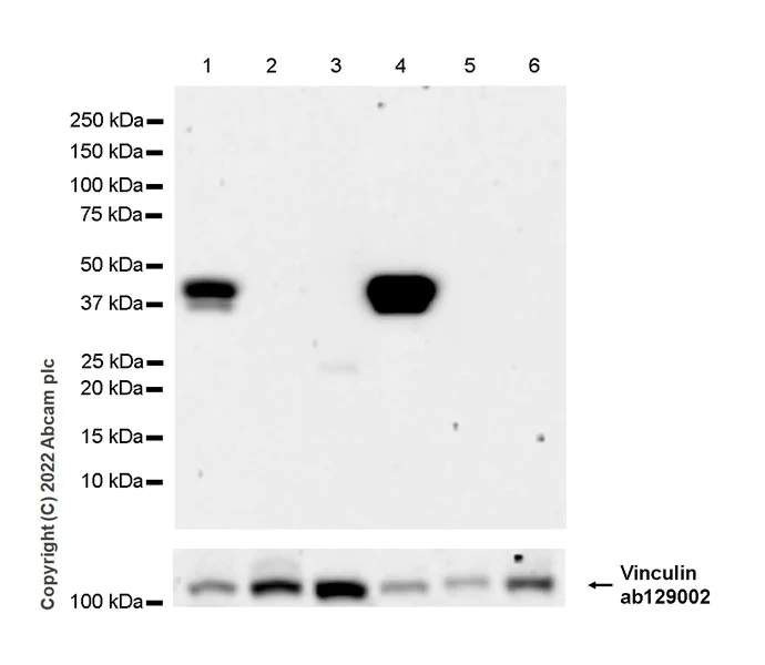 Western blot - Anti-Vinculin antibody [EPR8185] - Loading Control (AB129002)