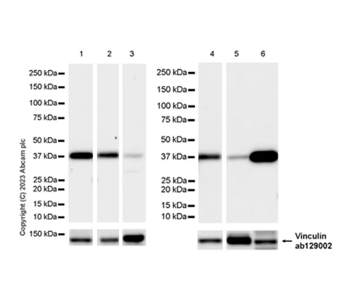 Western blot - Anti-Vinculin antibody [EPR8185] - Loading Control (AB129002)