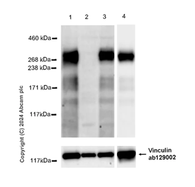 Western blot - Anti-Vinculin antibody [EPR8185] - Loading Control (AB129002)