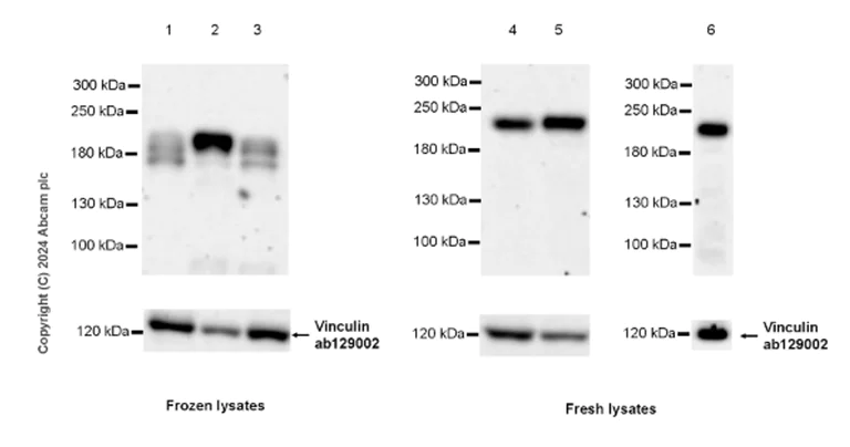 Western blot - Anti-Vinculin antibody [EPR8185] - Loading Control (AB129002)