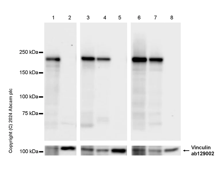 Western blot - Anti-Vinculin antibody [EPR8185] - Loading Control (AB129002)