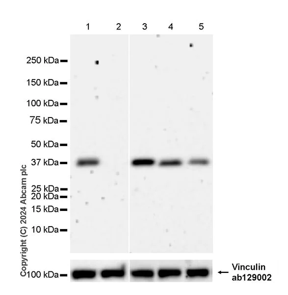 Western blot - Anti-Vinculin antibody [EPR8185] - Loading Control (AB129002)