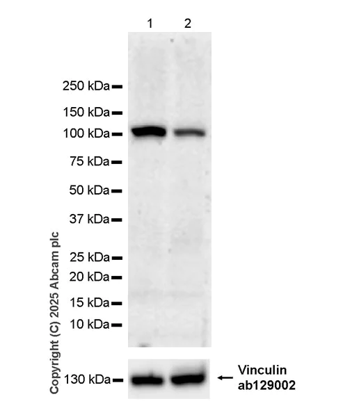 Western blot - Anti-Vinculin antibody [EPR8185] - Loading Control (AB129002)