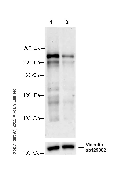 Western blot - Anti-Vinculin antibody [EPR8185] - Loading Control (AB129002)