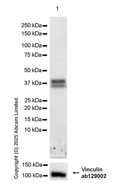 Western blot - Anti-Vinculin antibody [EPR8185] - Loading Control (AB129002)