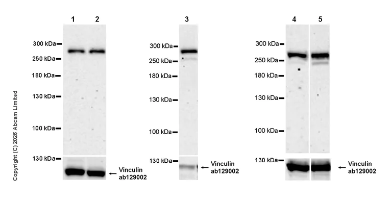 Western blot - Anti-Vinculin antibody [EPR8185] - Loading Control (AB129002)