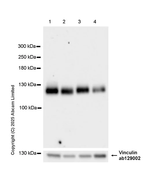 Western blot - Anti-Vinculin antibody [EPR8185] - Loading Control (AB129002)