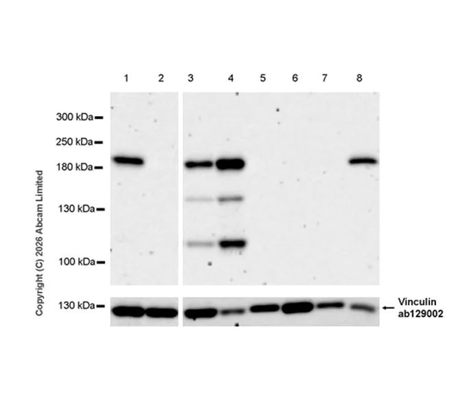 Western blot - Anti-Vinculin antibody [EPR8185] - Loading Control (AB129002)