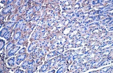 Immunohistochemistry (Formalin/PFA-fixed paraffin-embedded sections) - Anti-Vinculin antibody [HL1873] - BSA and Azide free (AB313865)