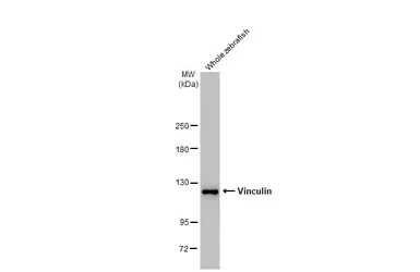 Western blot - Anti-Vinculin antibody [HL1873] - BSA and Azide free (AB313865)