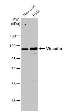 Western blot - Anti-Vinculin antibody [HL1873] - BSA and Azide free (AB313865), expandable thumbnail