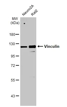 Western blot - Anti-Vinculin antibody [HL1873] - BSA and Azide free (AB313865)