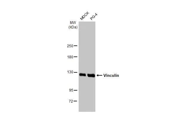 Western blot - Anti-Vinculin antibody [HL1873] - BSA and Azide free (AB313865)