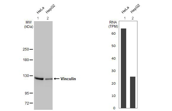 Western blot - Anti-Vinculin antibody [HL1873] - BSA and Azide free (AB313865), expandable thumbnail