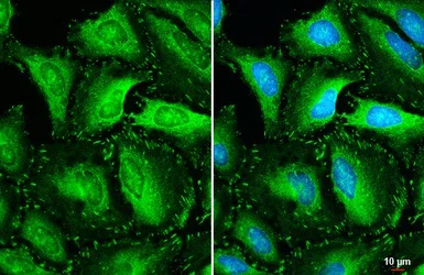 Immunocytochemistry/ Immunofluorescence - Anti-Vinculin antibody - Loading Control (AB155120)