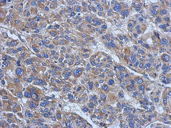Immunohistochemistry (Formalin/PFA-fixed paraffin-embedded sections) - Anti-Vinculin antibody - Loading Control (AB155120)