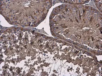 Immunohistochemistry (Formalin/PFA-fixed paraffin-embedded sections) - Anti-Vinculin antibody - Loading Control (AB155120)