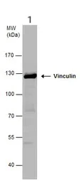 Western blot - Anti-Vinculin antibody - Loading Control (AB155120)