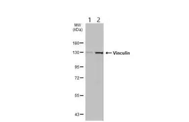 Western blot - Anti-Vinculin antibody - Loading Control (AB155120)