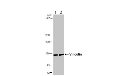 Western blot - Anti-Vinculin antibody - Loading Control (AB155120)