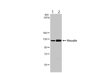 Western blot - Anti-Vinculin antibody - Loading Control (AB155120)