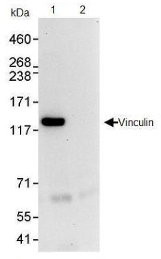 Immunoprecipitation - Anti-Vinculin antibody - Loading Control (AB91459), expandable thumbnail