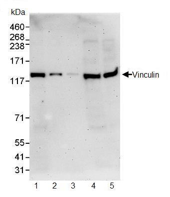 Western blot - Anti-Vinculin antibody - Loading Control (AB91459), expandable thumbnail