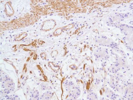 Immunohistochemistry (Formalin/PFA-fixed paraffin-embedded sections) - Anti-Vinculin antibody [SP117] - BSA and Azide free (AB240945)