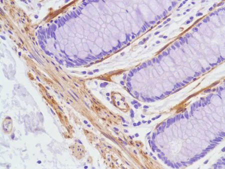 Immunohistochemistry (Formalin/PFA-fixed paraffin-embedded sections) - Anti-Vinculin antibody [SP117] - BSA and Azide free (AB240945)