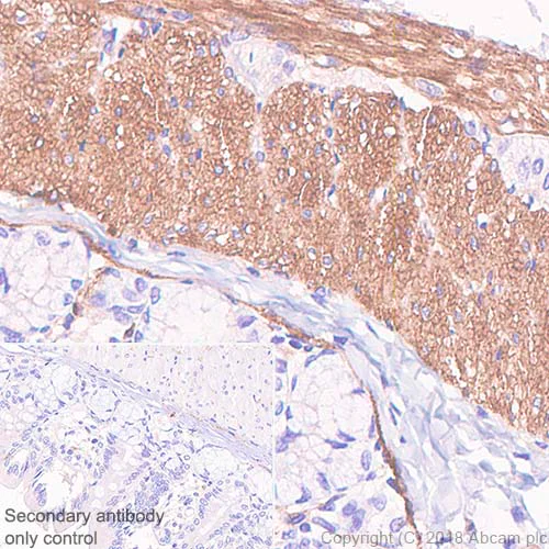 Immunohistochemistry (Formalin/PFA-fixed paraffin-embedded sections) - Anti-Vinculin antibody [SP117] - BSA and Azide free (AB240945)