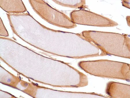 Immunohistochemistry (Formalin/PFA-fixed paraffin-embedded sections) - Anti-Vinculin antibody [SP117] - BSA and Azide free (AB240945)