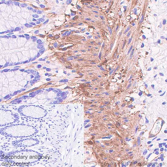 Immunohistochemistry (Formalin/PFA-fixed paraffin-embedded sections) - Anti-Vinculin antibody [SP117] - BSA and Azide free (AB240945)