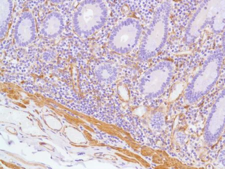 Immunohistochemistry (Formalin/PFA-fixed paraffin-embedded sections) - Anti-Vinculin antibody [SP117] - BSA and Azide free (AB240945)