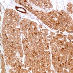 Immunohistochemistry (Formalin/PFA-fixed paraffin-embedded sections) - Anti-Vinculin antibody [SP117] - C-terminal (AB111004)