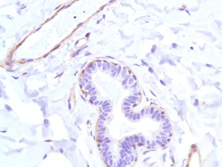 Immunohistochemistry (Formalin/PFA-fixed paraffin-embedded sections) - Anti-Vinculin antibody [SP117] - C-terminal (AB111004)