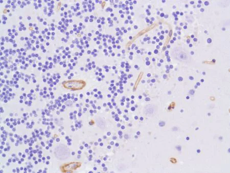 Immunohistochemistry (Formalin/PFA-fixed paraffin-embedded sections) - Anti-Vinculin antibody [SP117] - C-terminal (AB111004)