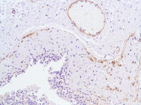 Immunohistochemistry (Formalin/PFA-fixed paraffin-embedded sections) - Anti-Vinculin antibody [SP117] - C-terminal (AB111004)